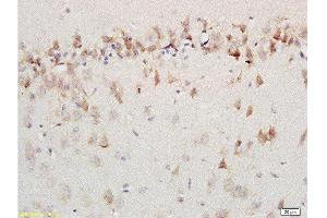 Formalin-fixed and paraffin embedded labeled with rat brain Anti-AMBRA1 Polyclonal Antibody, Unconjugated 1:200 followed by conjugation to the secondary antibody and DAB staining (AMBRA1 抗体  (AA 221-320))