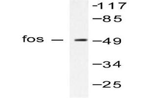 Image no. 1 for anti-c-Fos (c-Fos) antibody (ABIN265423) (c-FOS 抗体)