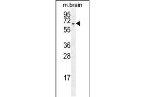 Western blot analysis in mouse brain tissue lysates (35ug/lane). (FBXO21 抗体  (C-Term))