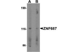 Western blot analysis of ZNF687 in Jurkat cell lysate with ZNF687 Antibody  at 0. (ZNF687 抗体  (C-Term))