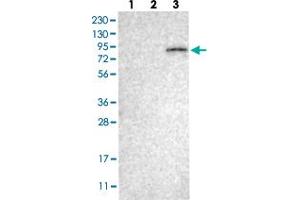 Western Blot (Cell lysate) analysis with ELMO2 polyclonal antibody  Lane 1: Human cell line RT-4 Lane 2: Human cell line U-251MG sp Lane 3: Human plasma (IgG/HSA depleted) (ELMO2 抗体)