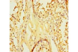 Immunohistochemistry of paraffin-embedded human testis tissue using ABIN7166855 at dilution of 1:100 (C8orf77 抗体  (AA 1-214))