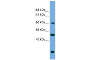 Image no. 1 for anti-Exocyst Complex Component 1 (EXOC1) (AA 35-84) antibody (ABIN6745695) (EXOC1 抗体  (AA 35-84))