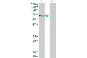 Western Blot analysis of STK3 expression in transfected 293T cell line by STK3 monoclonal antibody (M13), clone 4F7.