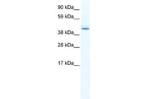 WB Suggested Anti-DDX49 Antibody Titration:  2. (DDX49 抗体  (N-Term))