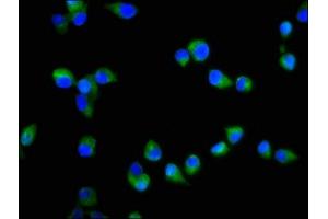 Immunofluorescence staining of SH-SY5Y cells with ABIN7170569 at 1:200, counter-stained with DAPI. (S1PR2 抗体  (AA 293-353))