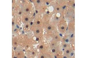 Used in DAB staining on fromalin fixed paraffin-embedded liver tissue (FKBPL 抗体  (AA 1-349))
