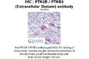 Image no. 1 for anti-Parathyroid Hormone 2 Receptor (PTH2R) (1st Extracellular Domain), (pThr2) antibody (ABIN1738582) (PTH2R 抗体  (1st Extracellular Domain, pThr2))