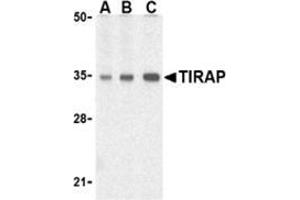 Western blot analysis of TIRAP in human heart cell lysates with this product at (A) 0. (TIRAP 抗体  (C-Term))
