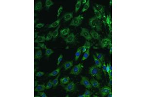 Immunofluorescence analysis of C6 cells using Galectin 3/Galectin 3/LG antibody (ABIN6130437, ABIN6143158, ABIN6143159 and ABIN7101422) at dilution of 1:100. (Galectin 3 抗体  (AA 1-250))