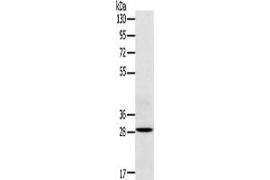 Western Blotting (WB) image for anti-Triggering Receptor Expressed On Myeloid Cells 2 (TREM2) antibody (ABIN2434061) (TREM2 抗体)