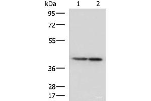 Western blot analysis of Human cerebella tissue and Human cerebrum tissue lysates using ATP6V1C1 Polyclonal Antibody at dilution of 1:500 (ATP6V1C1 抗体)