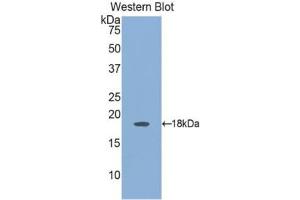 Western blot analysis of the recombinant protein. (Angiopoietin 2 抗体  (AA 24-165))