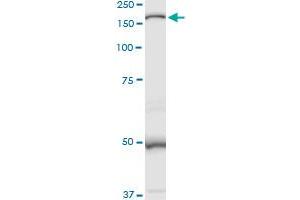 MAN2B1 MaxPab rabbit polyclonal antibody. (MAN2B1 抗体  (AA 1-1011))