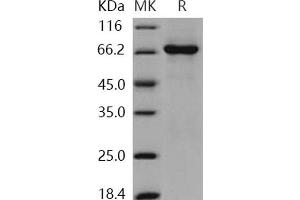 Western Blotting (WB) image for TAO Kinase 3 (TAOK3) (AA 1-411) (Active) protein (GST tag,His tag) (ABIN7317073) (TAO Kinase 3 Protein (TAOK3) (AA 1-411) (GST tag,His tag))