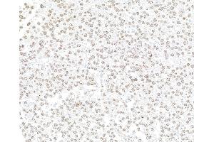 Immunohistochemistry (IHC) image for anti-Enhancer of Zeste Homolog 2 (EZH2) (C-Term) antibody (ABIN7795724)