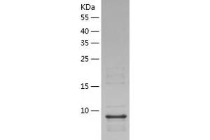 Western Blotting (WB) image for Aquaporin 4 (AQP4) (AA 253-323) protein (His tag) (ABIN7121882) (Aquaporin 4 Protein (AQP4) (AA 253-323) (His tag))