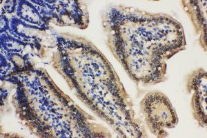 Anti-Lamin A+C antibody, IHC(P) IHC(P): Mouse Intestine Tissue (Lamin A/C 抗体  (C-Term))