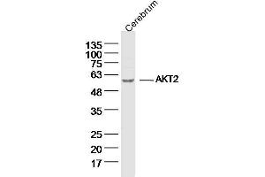 Mouse Cerebrum lysates probed with AKT2 Polyclonal Antibody, unconjugated  at 1:300 overnight at 4°C followed by a conjugated secondary antibody for 60 minutes at 37°C. (AKT2 抗体  (AA 101-200))