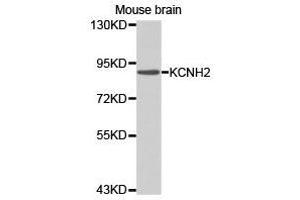 Western Blotting (WB) image for anti-Potassium Voltage-Gated Channel, Subfamily H (Eag-Related), Member 2 (KCNH2) antibody (ABIN1873378) (KCNH2 抗体)