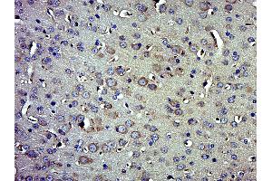 Immunohistochemistry (Paraffin-embedded Sections) (IHC (p)) image for anti-Beclin 1, Autophagy Related (BECN1) (AA 160-190) antibody (ABIN4997328)