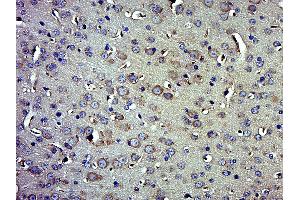 Paraformaldehyde-fixed, paraffin embedded Mouse brain Antigen retrieval by boiling in sodium citrate buffer (pH6. (Beclin 1 抗体  (AA 160-190))