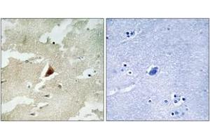 Immunohistochemistry analysis of paraffin-embedded human brain tissue, using MAPKAPK5 Antibody. (MAPKAP Kinase 5 抗体  (AA 171-220))