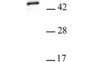 PHF6 antibody (pAb) tested by Western blot. (PHF6 抗体  (Isoform 1, N-Term))