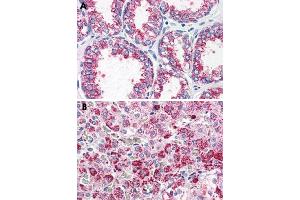Immunohistochemical staining of formalin-fixed, paraffin-embedded human prostate (A) and human adrenal gland (B) tissue after heat-induced antigen retrieval. (CCKAR 抗体  (Internal Region))