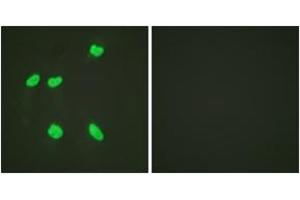 Immunofluorescence analysis of HeLa cells, using Histone H4 (Acetyl-Lys16) Antibody. (Histone H4 抗体  (acLys16))