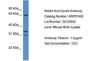 WB Suggested Anti-Cpne5  Antibody Titration: 0. (Copine V 抗体  (N-Term))