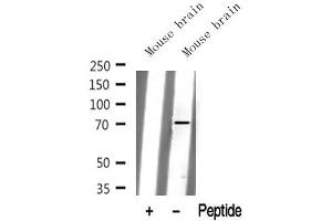 Western blot analysis of extracts of Mouse brain tissue sample,using Kv3.