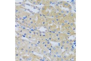 Immunohistochemistry of paraffin-embedded mouse kidney using C antibody (ABIN6129635, ABIN6137807, ABIN6137808 and ABIN6217796) at dilution of 1:100 (40x lens). (CABP7 抗体  (AA 100-180))