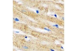 Immunohistochemical analysis of IL-18BP staining in mouse heart formalin fixed paraffin embedded tissue section. (IL18BP 抗体)