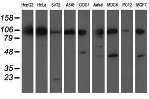 Image no. 2 for anti-Excision Repair Cross-Complementing Rodent Repair Deficiency, Complementation Group 4 (ERCC4) antibody (ABIN1498073) (ERCC4 抗体)