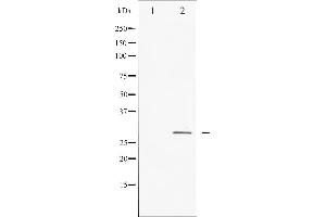 Western blot analysis of HSP27 expression in Ca2+ treated HeLa whole cell lysates,The lane on the left is treated with the antigen-specific peptide. (HSP27 抗体  (Internal Region))