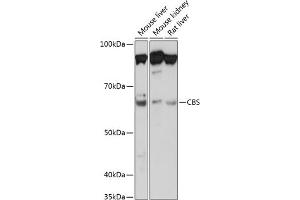 Western blot analysis of extracts of various cell lines, using CBS Rabbit mAb (ABIN7266615) at 1:1000 dilution. (CBS 抗体)
