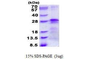Figure annotation denotes ug of protein loaded and % gel used. (BTF3 蛋白)