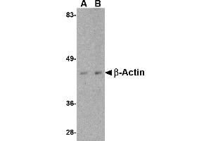 Western blot analysis of actin in HeLa cell lysate with beta-actin antibody at (A) 1 and (B) 2 µg/mL. (beta Actin 抗体  (C-Term))