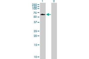 Western Blot analysis of ACD expression in transfected 293T cell line by ACD MaxPab polyclonal antibody. (ACD 抗体  (AA 1-544))