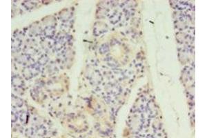 Immunohistochemistry of paraffin-embedded human pancreatic tissue using ABIN7170733 at dilution of 1:100 (STRADB 抗体  (AA 212-418))