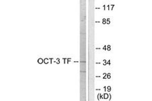 Western blot analysis of extracts from HeLa cells, using OCT3 Antibody.