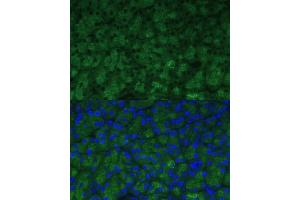 Immunofluorescence analysis of mouse pancreas using CTRB1 Polyclonal Antibody (ABIN7266398) at dilution of 1:100 (40x lens). (CTRB1 抗体  (AA 79-263))