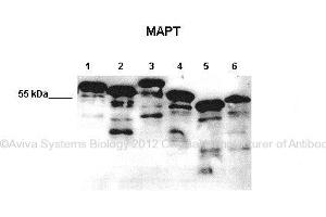 Researcher: Max Holzer, Paul Flechsig Institut of Brain Research, University of Leipzig  Application: Western blotting  Species + Tissue/Cell type:   Lane 1: 10ug E. (MAPT 抗体  (Middle Region))