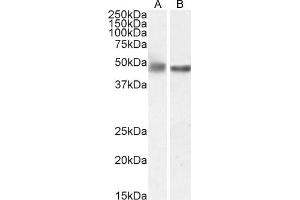 Western Blotting (WB) image for anti-Glial Fibrillary Acidic Protein (GFAP) (C-Term) antibody (ABIN185730)