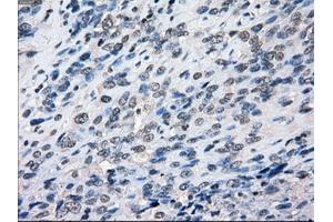 Image no. 4 for anti-Budding Uninhibited By Benzimidazoles 1 Homolog beta (Yeast) (BUB1B) antibody (ABIN1496995) (BUB1B 抗体)