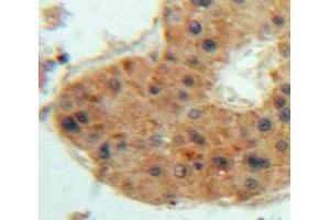 Used in DAB staining on fromalin fixed paraffin-embedded Liver tissue (Thrombopoietin 抗体  (AA 24-266))