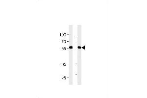 RFTN1 Antibody (Center) (ABIN1881746 and ABIN2843233) western blot analysis in MDA-MB-231,NCI- cell line lysates (35 μg/lane). (RFTN1 抗体  (AA 169-198))