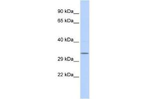 WB Suggested Anti-NMRAL1 Antibody Titration: 0. (NMRAL1 抗体  (Middle Region))