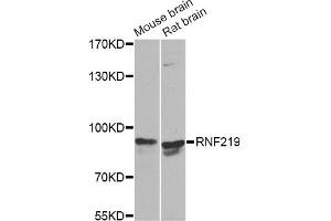 Western blot analysis of extracts of various cell lines, using RNF219 Antibody. (RNF219 抗体)